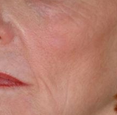 Before and after genesis photo 11
