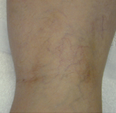 Before and after photo 4