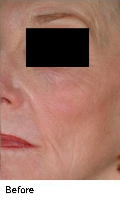 Before and after photo 9