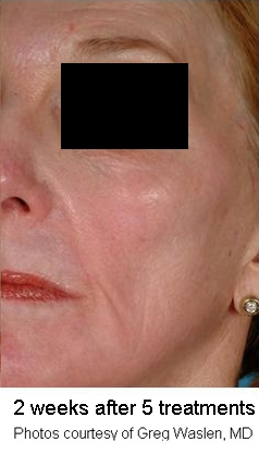 Before and after photo 10