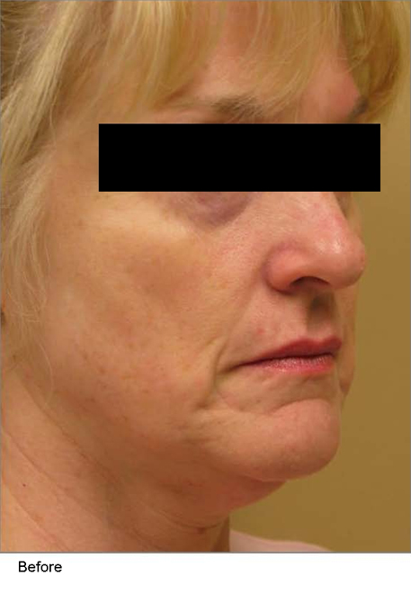 Before and after photo 1