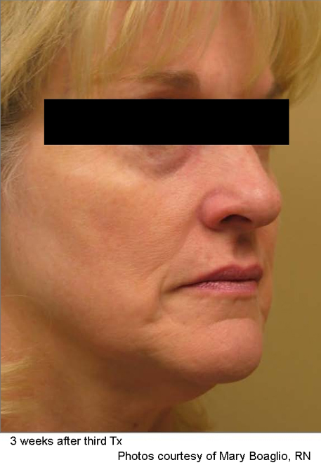 Before and after photo 2