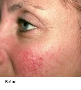 Before and after photo 5