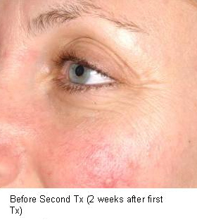 Before and after photo 6