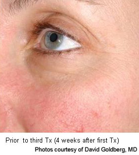 Before and after photo 7