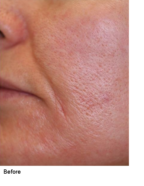 Before and after photo 9